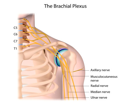 Brachial Plexus Injury Treatment | Rehabilitation & Physical Therapy in