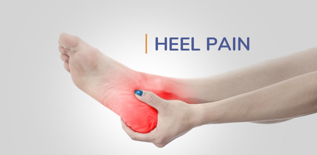 heel pain treatment