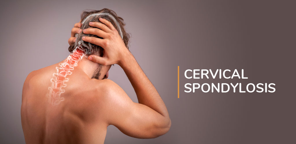cervical spondylitis treatment