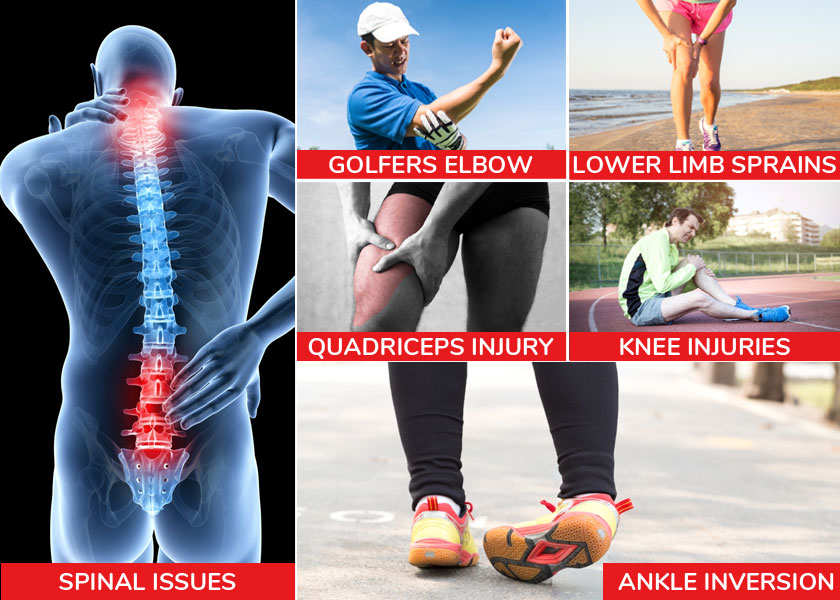 sports injury physiotherapy