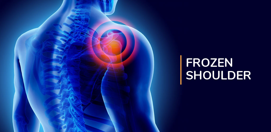 Frozen Shoulder Treatment