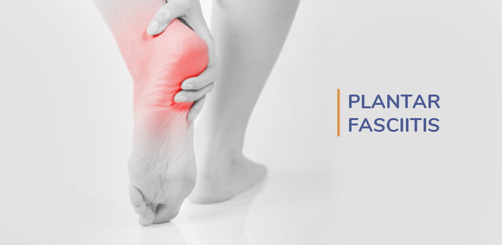 Plantar Fasciitis Treatment