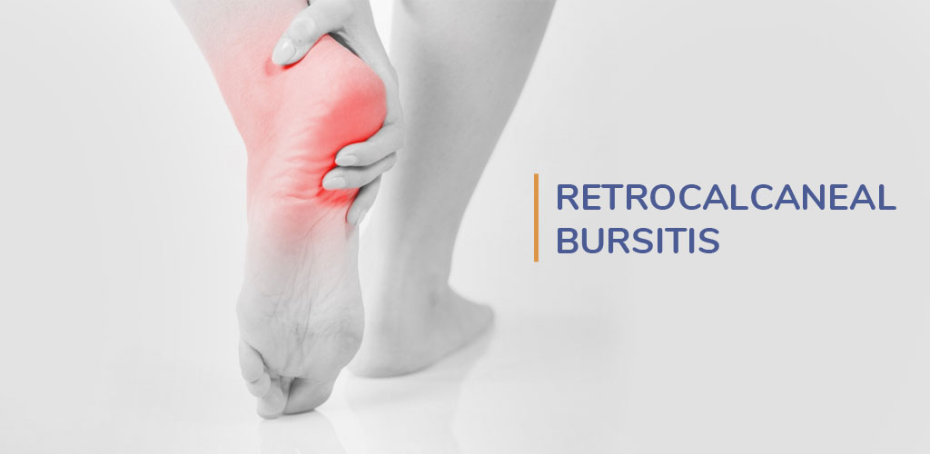 retrocalcaneal bursitis