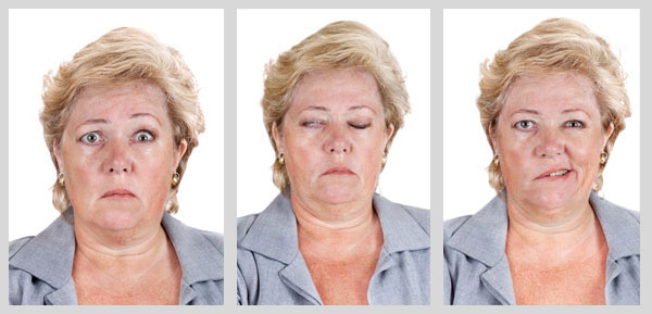 bell's palsy physical therapy