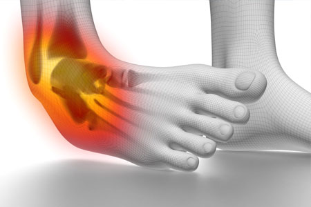 ankle sprain rehab